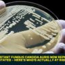 Drug-Resistant Fungus Candida Auris Now Reported in 27 States — Here's Who's Actually at Risk